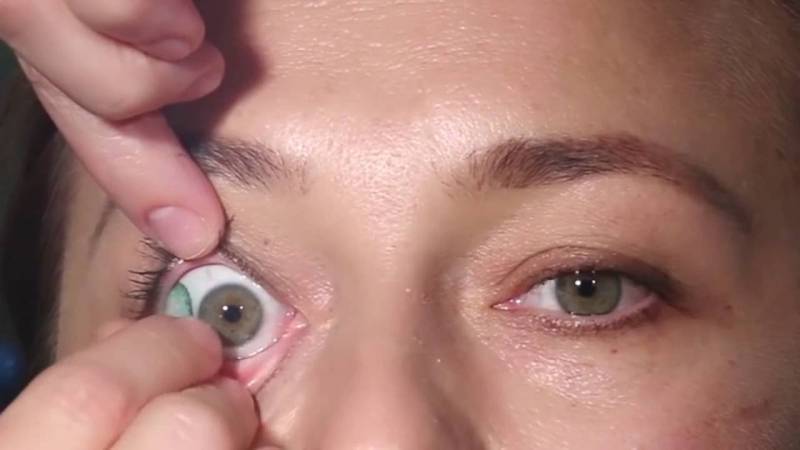 Химический ожог глаз: первая помощь, методы лечения, капли в глаза