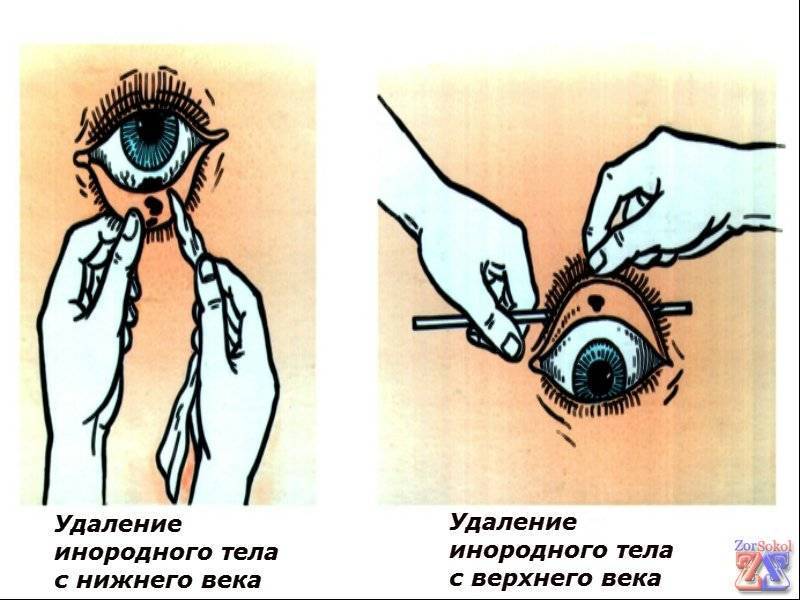 Глазные капли при травме глаз | тауфон